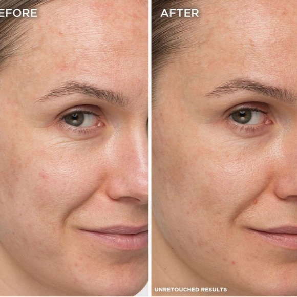 🆕 IT Cosmetics Confidence in a Cream Anti-Aging Armour Moisturizer. NWT. - Picture 9 of 11